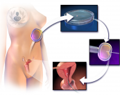 reproduccion-asistida