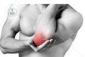 dolor-codo-epicondilitis