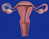 Cáncer de ovario, qué es y cómo se trata
