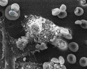 inmunologia-inmunologia-sistema-inmunologico