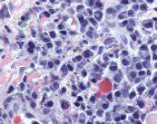 hematologia-sangre