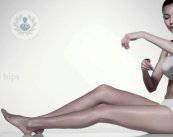 carboxiterapia-celulitis-ojeras