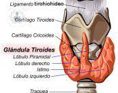 Intervención de la extirpación de la glándula tiroides