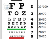 lente-intraocular