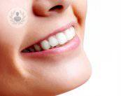 implantes-cigomaticos-estetica