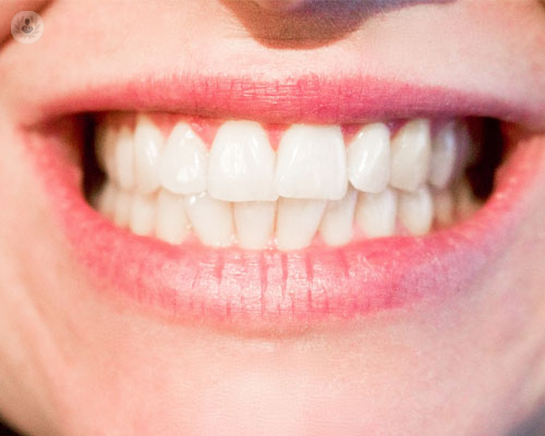 5 avances decisivos de los implantes dentales