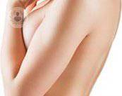 aumento-pecho-embarazada