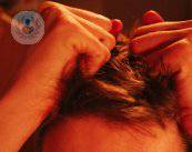 La caída del cabello: ¿qué tratamientos existen?