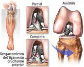 imagenes-artroscopia