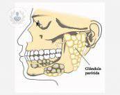glandula-parotida-patologias-y-tratamientos