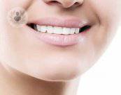 como-eliminar-el-surco-nasogeniano