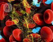 disminucion-plaquetas-trombocitopenia-gestacional