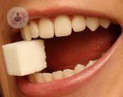 dientes-caries