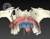 planificacion-3d