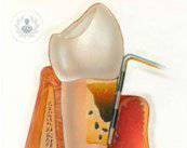 periodoncia