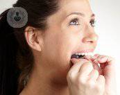 protesis-dental-fija-o-removible