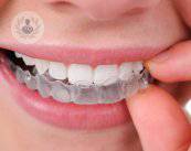 La ortodoncia ya no es solo para niños y adolescentes