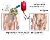 trasplante-de-medula