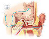 partes-del-oido-hipoacusia