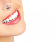 Estética dental para lucir una sonrisa perfecta