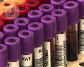 trasplante-de-medula-y-sangre