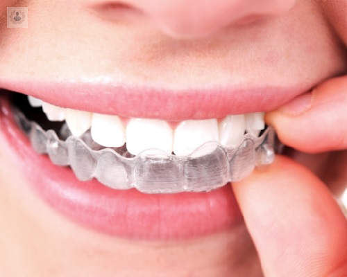 Ortodoncia e invisible, ¿es posible?