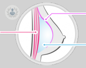 Técnica subfascial para aumento de mamas: más segura y menos dolorosa