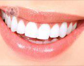 Ventajas de las carillas dentales en color, forma y tamaño del diente