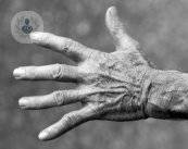 articulaciones-con-artrosis