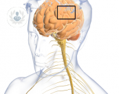 esclerosis-multiple-en-personas-jovenes