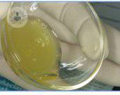 plasma-rico-en-plaquetas-para-cicatrizacion-dental