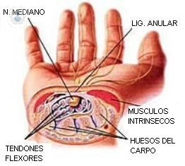 sindrome-del-tunel-carpiano