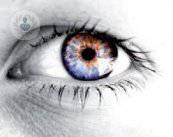 Queratocono: alteración ocular de la córnea