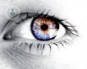 ojo