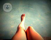tratamiento-varices