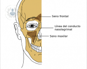 seno-maxilar