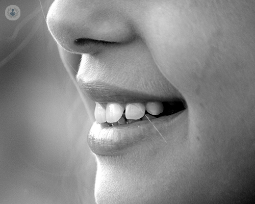 Estética dental: la combinación para una sonrisa estética y armónica