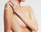 aumento-de-senos-tecnicas-protesis