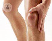 rodilla