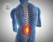 dolor-de-ciatica-tratamiento