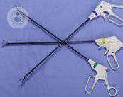 3 puntos clave de la cirugía laparoscópica
