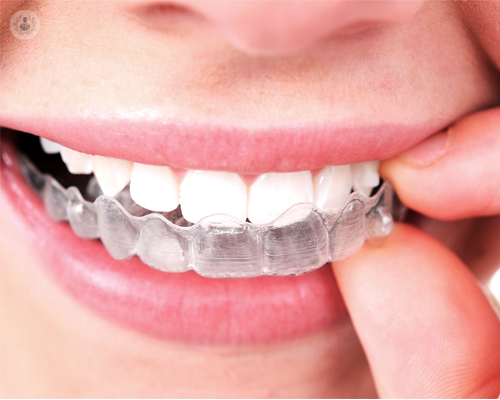 Invisalign u ortodoncia invisible para alinear los dientes de forma imperceptible