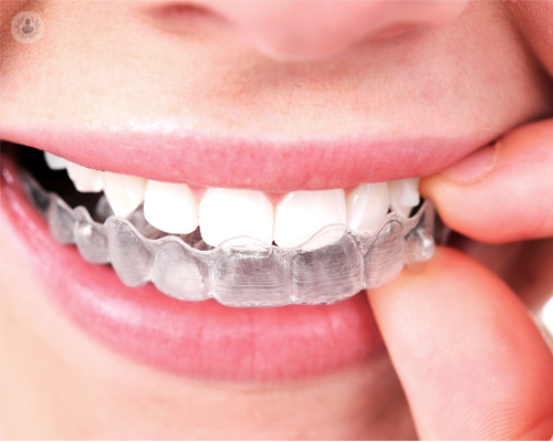 invisalign-u-ortodoncia-invisible