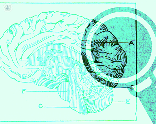 enfermedades-cerebrovasculares-o-patologia-vascular