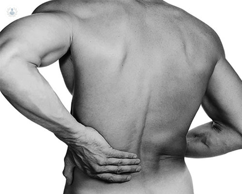 Dolor de espalda: síntomas, causas y tratamiento