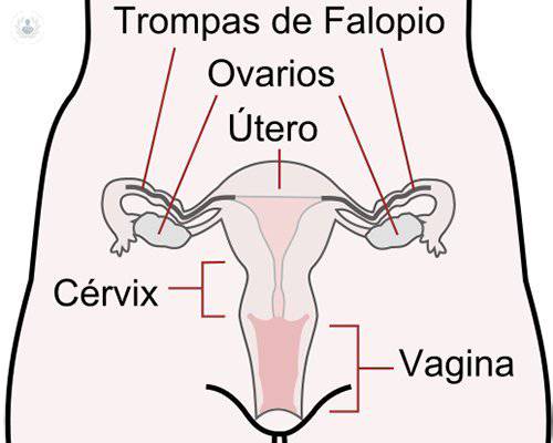 ¿Qué son los pólipos endometriales y cuándo acudir al especialista?