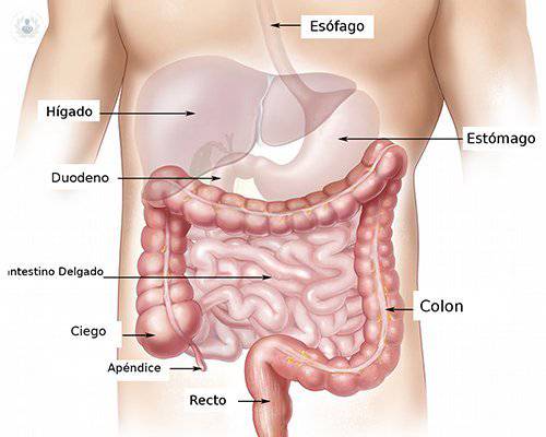 ¿Cuál es la causa de la aparición del cáncer de colon?