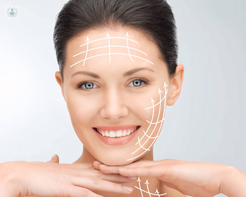 lifting-facial-sin-cirugia