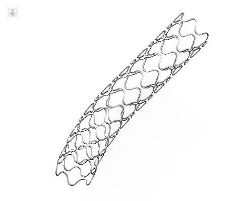 stent-periferico