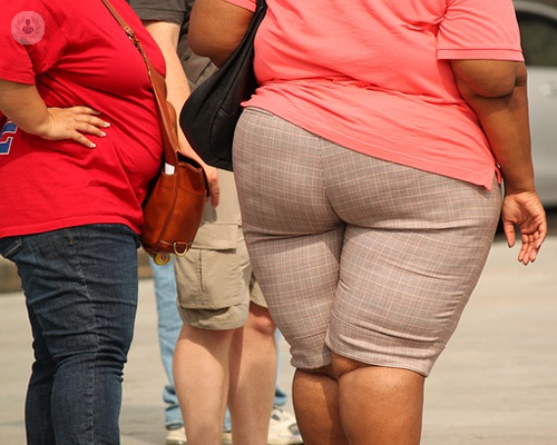 Obesidad Mórbida: cuándo supone un problema de salud y cómo tratarla